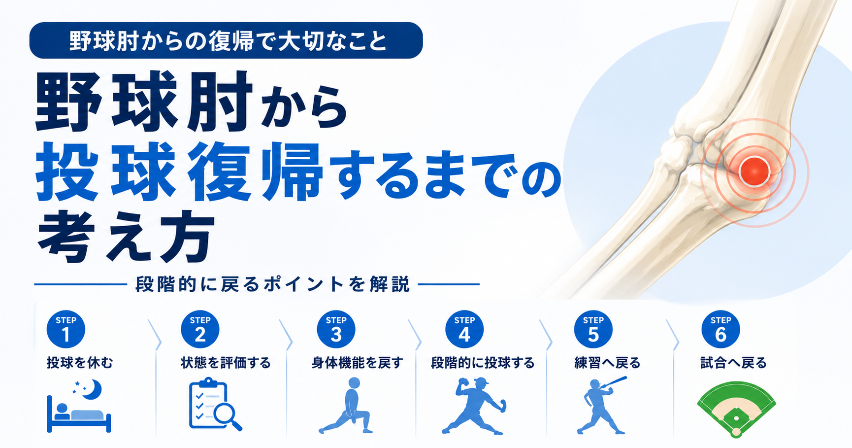 野球肘から投球復帰するまでの段階的な流れを示したイラスト