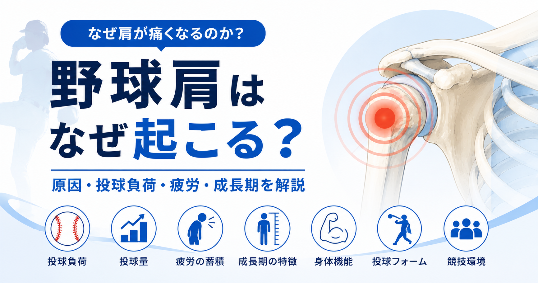 野球肩が起こる複数の要因を示すイラスト