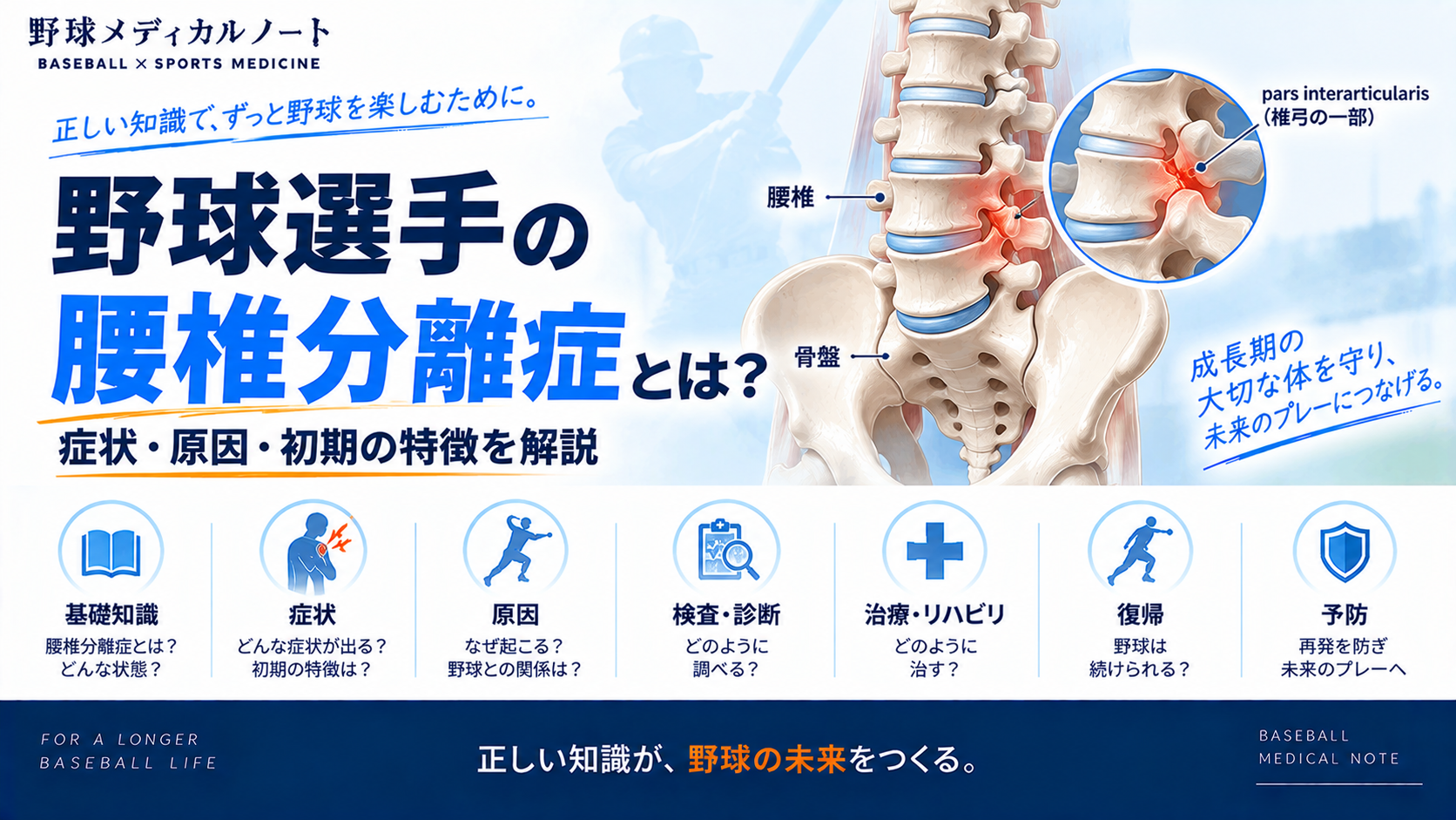 野球選手の腰椎分離症について、腰椎・骨盤とpars interarticularisを示し、症状・原因・検査・治療・復帰・予防を整理したインフォグラフィック