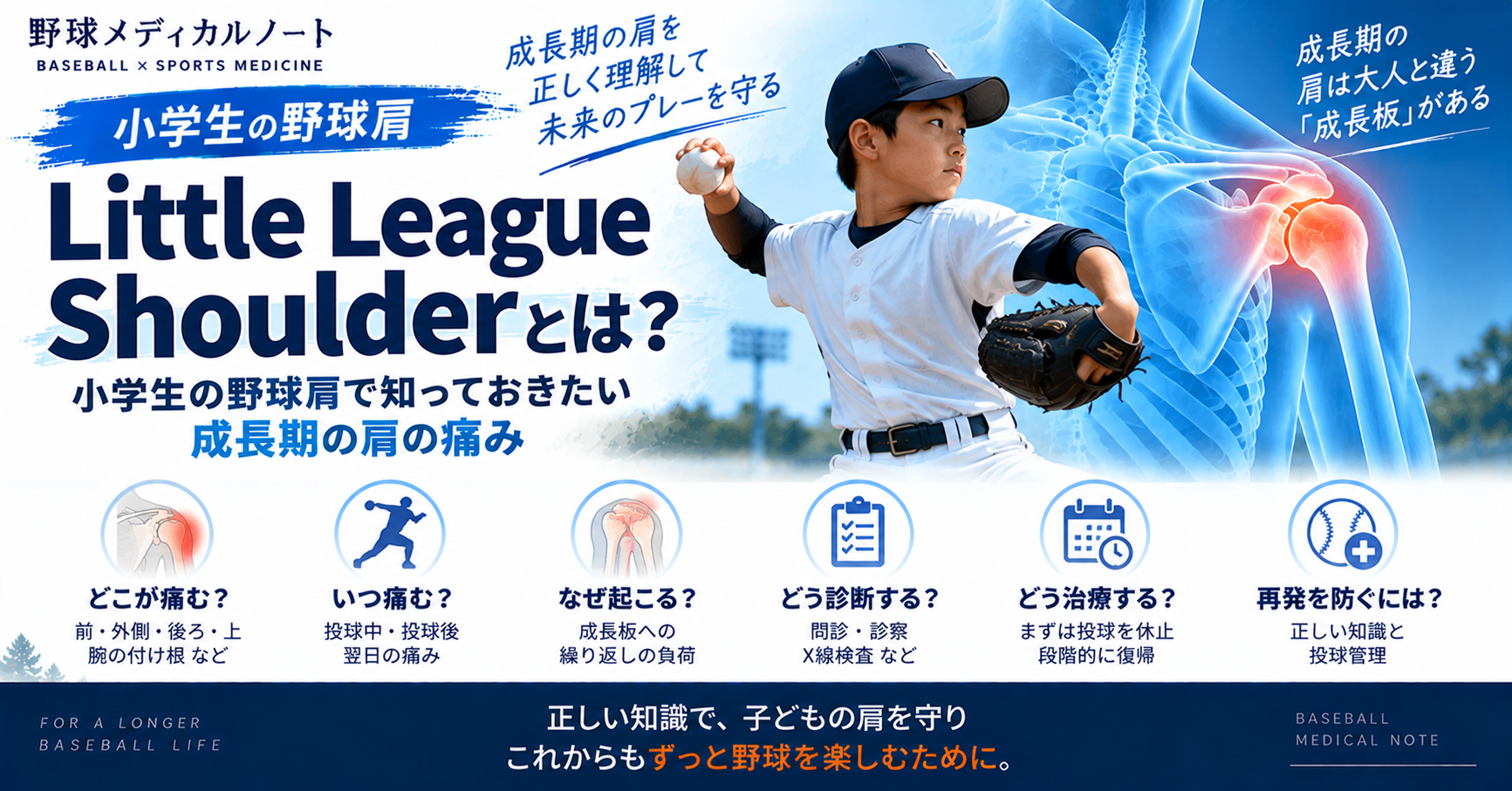 Little League Shoulderと成長期の野球肩について、症状・原因・診断・治療を示したインフォグラフィック